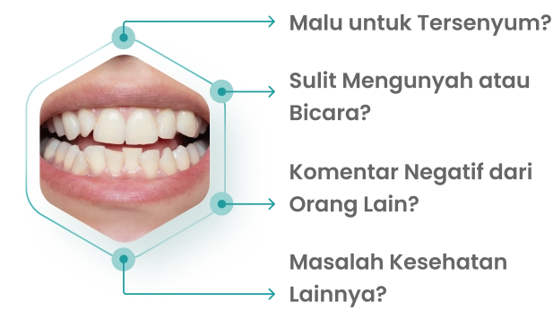 gigi tidak rapi