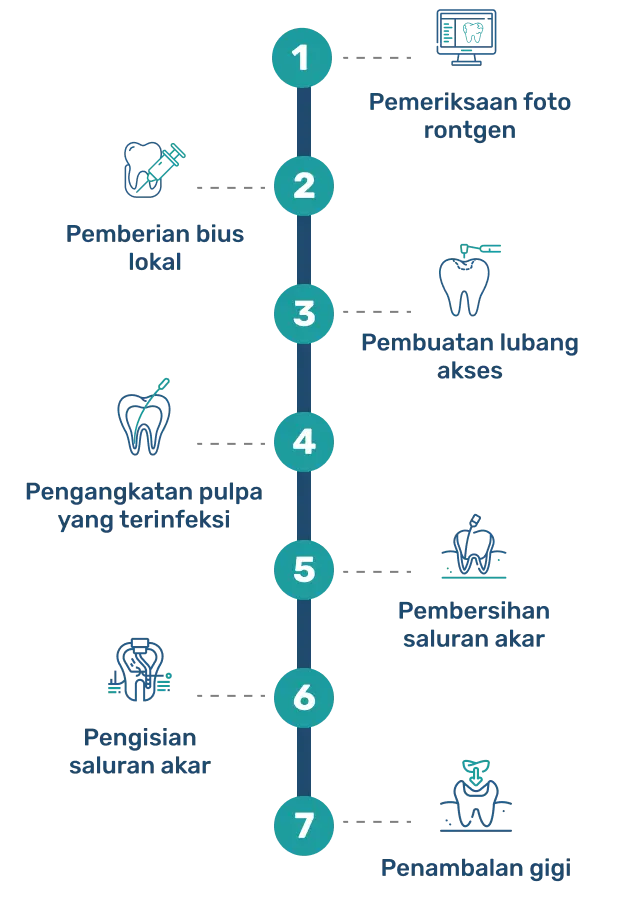 Proses Perawatan Saluran Akar